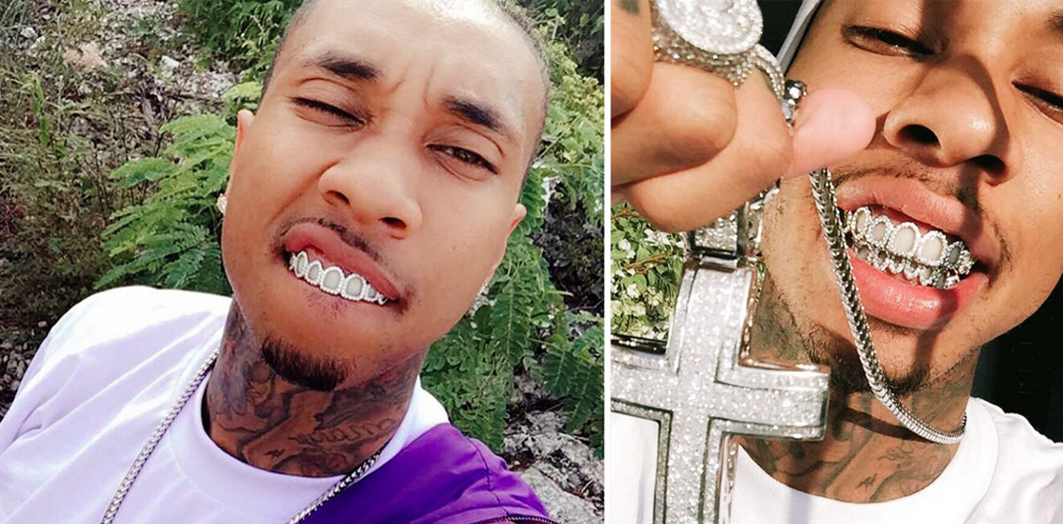 Wohin mit meinem Geld? Rapper Tyga investiert in 45.000 $-Grillz