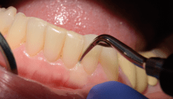 Schall versus Ultraschall