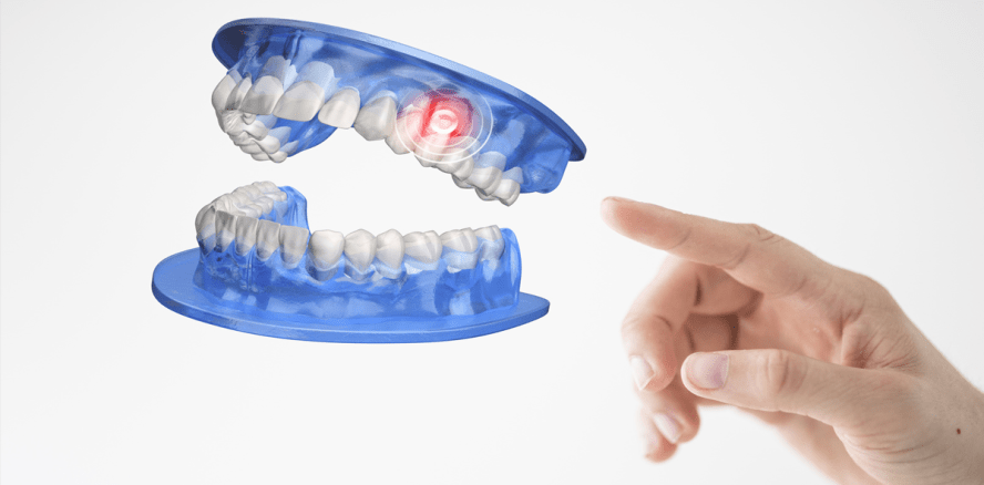 Das zahlt Deutschland beim Zahnersatz