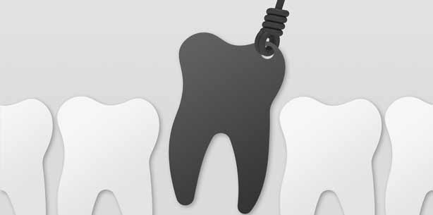 Darum wird in Deutschland so wenig implantiert!