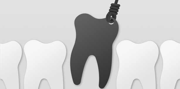 Darum wird in Deutschland so wenig implantiert!