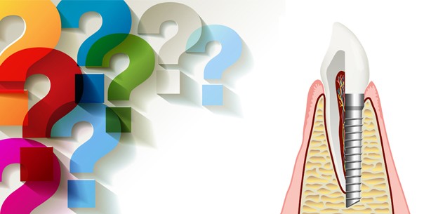 Warum wird in Deutschland so wenig implantiert? – Leserumfrage