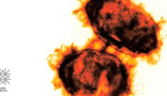 Bakterien schleusen DNA in menschliche Zellen ein