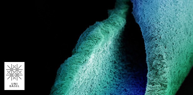 Gut geschützt: Krankheitserreger im Biofilm
