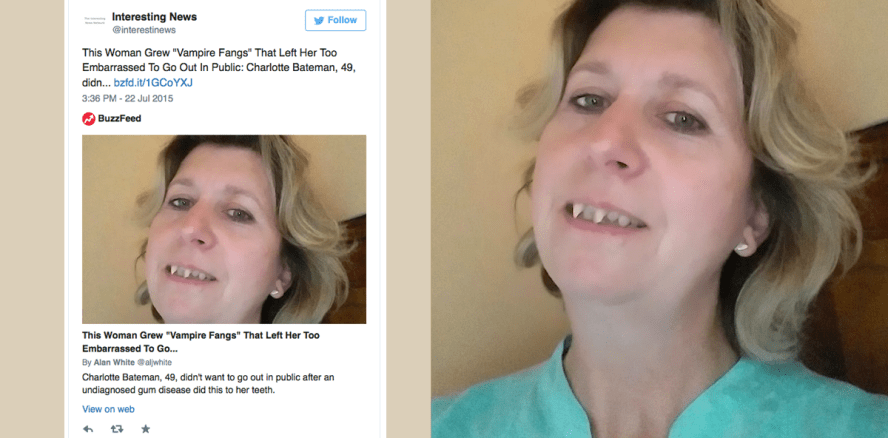 Vampirzähne: 35.000 Euro Schadenersatz für Fehldiagnose