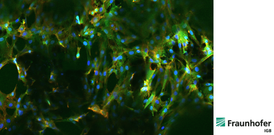 Vaskularisierte Knochenimplantate aus dem „Baukasten“