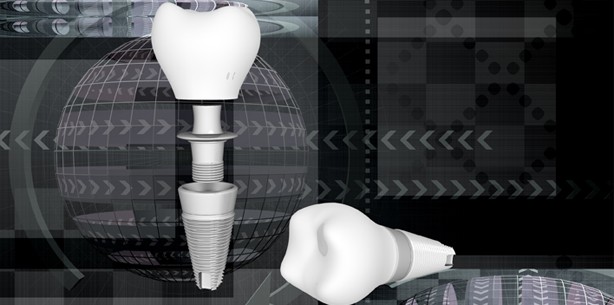 Innovationsbedingungen für Implantate müssen verbessert werden