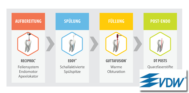 VDW: So einfach geht Endo heute