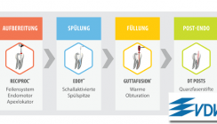 VDW: So einfach geht Endo heute