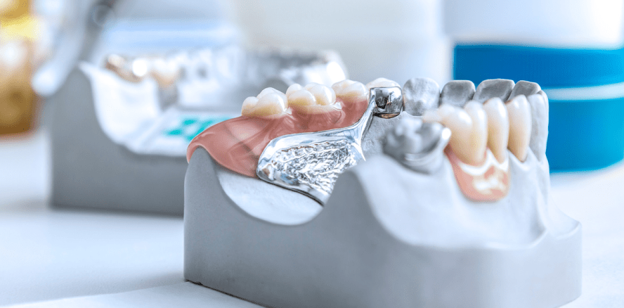 Gewerbe der Zahntechniker mit geringem Umsatzplus