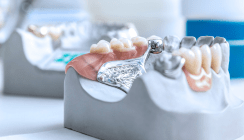 Gewerbe der Zahntechniker mit geringem Umsatzplus