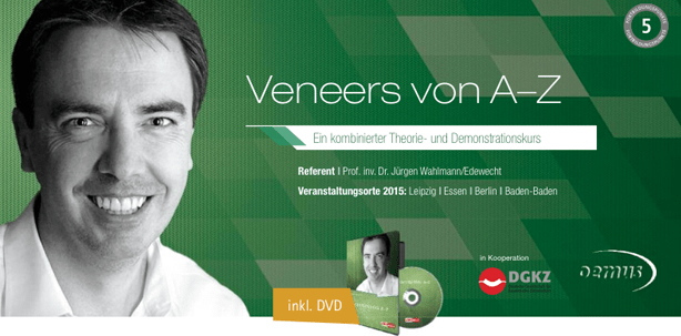 Ästhetik im Fokus: „Veneers von A–Z“