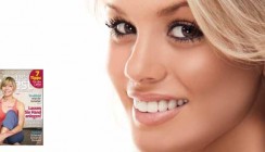 Veneers bringen Zähne zum Strahlen, aber das Kariesrisiko wächst