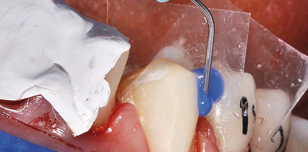 Nur Zähne – und doch große Kunst!