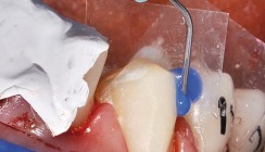 Nur Zähne – und doch große Kunst!