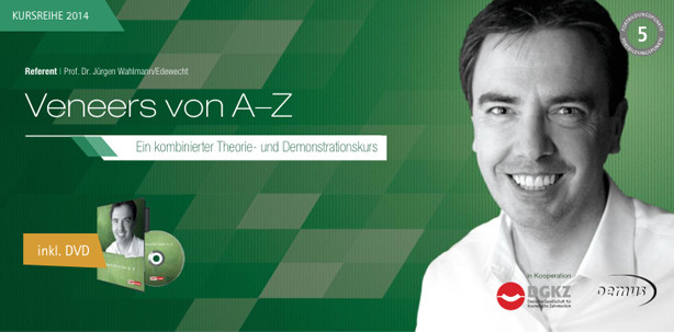 „Veneers von A–Z“