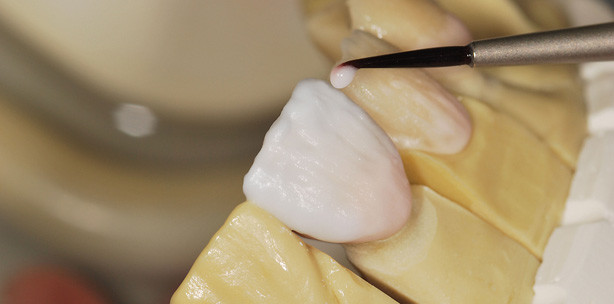 Welche Zukunft haben Verblendmaterialien?