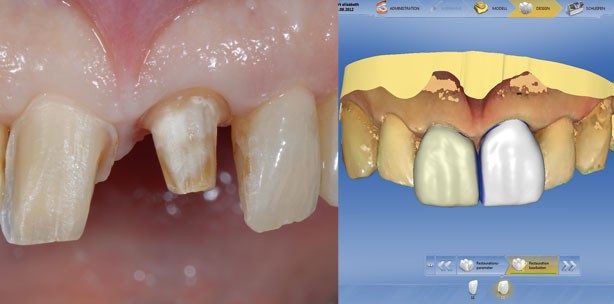 Verbundsystem aus Keramik und Polymer bietet neue Optionen