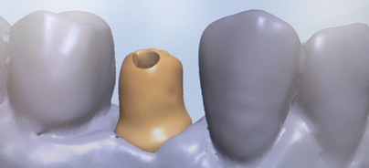 Vereinigung von Langlebigkeit und ­natürlicher Ästhetik