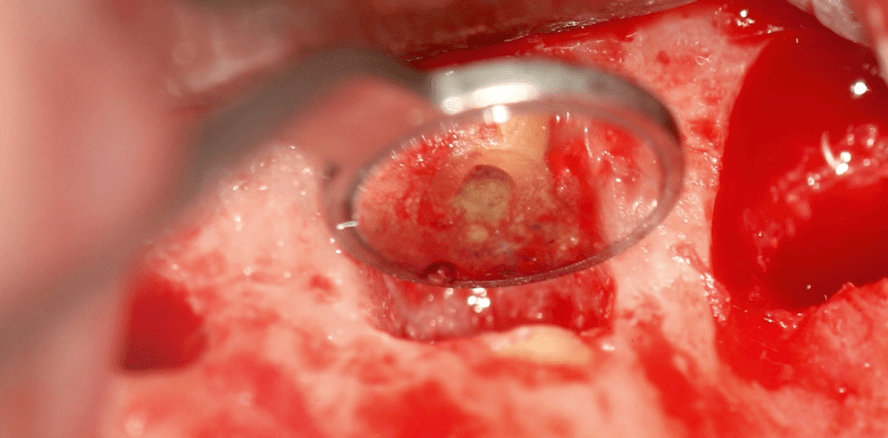 Verfahrensfehler vermeiden und somit den Erfolg sichern