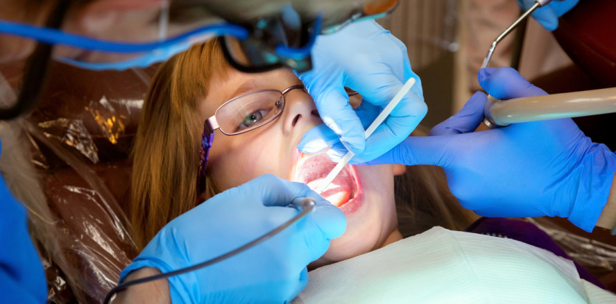 Nur noch wenige Kinder erhalten Zahnversiegelungen