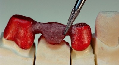 Keine Gefahr im Verzug