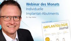 Webinar mit Dr. Kay Vietor zu individuellen Implantat-Abutments