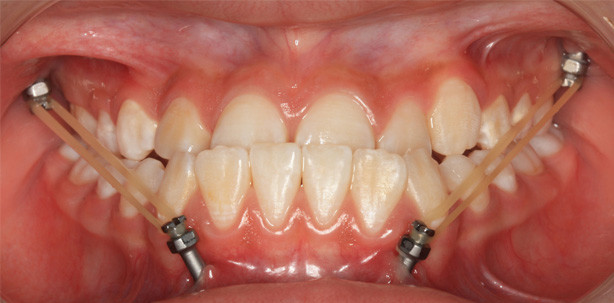 „Verlustrate geht gen Null“