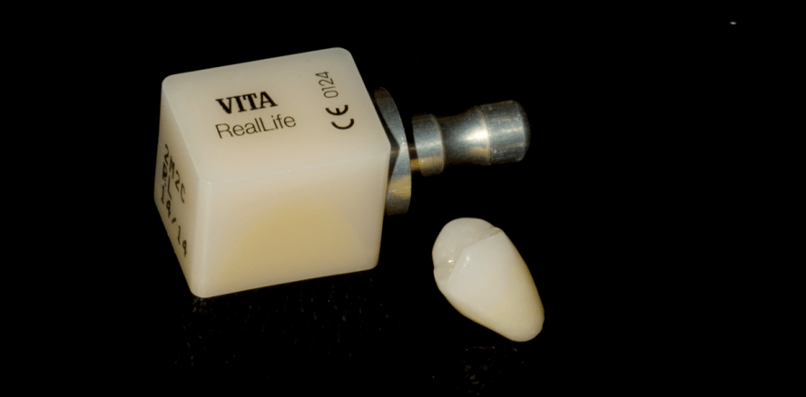 CEREC und Feldspatkeramik: Höchste Ästhetik in nur einer Sitzung