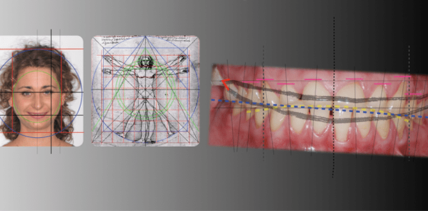 Erfolgsfaktoren keramischer CAD/CAM-Materialien