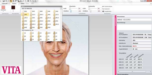 Verschiedene Patientenfälle, eine Software – viele Möglichkeiten