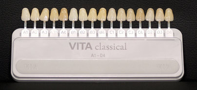 Visuelle und digitale Farbbestimmung