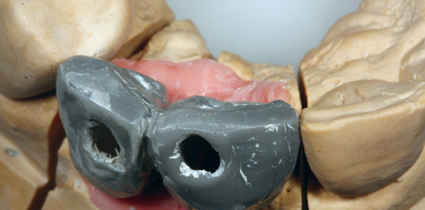 Premium-Zirkonoxid als Allrounder im Labor