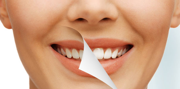 Zahnarzt darf mit Vorher-Nachher-Abbildungen werben