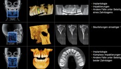 Vorteile und Nutzen von 3-D-Röntgen in Diagnostik, Planung, Therapie
