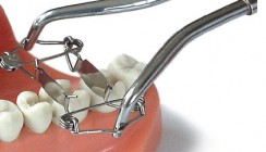 Walser Dental: In die Top zwei gewählt beim Industriepreis 2011
