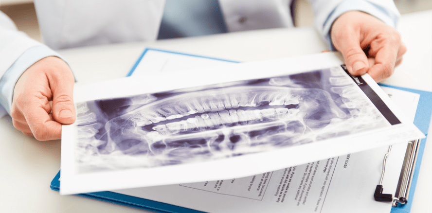 15 Implantologen im Praxistest: Wenig Info, viele Risiken