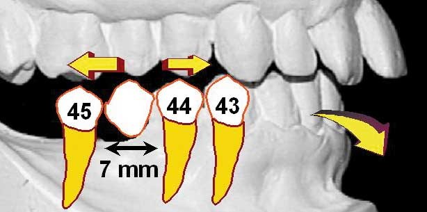 Rehabilitation der Funktion und Ästhetik