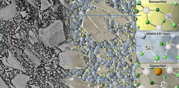 Webinar zu neuartigem Füllungsmaterial