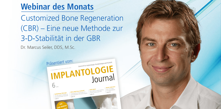 Live-Webinar zu Customized Bone Regeneration (CBR)
