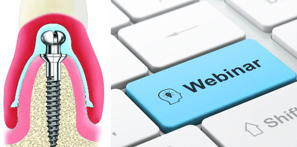 Webinar: Intensivkurs erklärt Fixierung von Totalprothesen