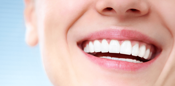 Wir können Bleaching! – Webinar des DT Study Clubs
