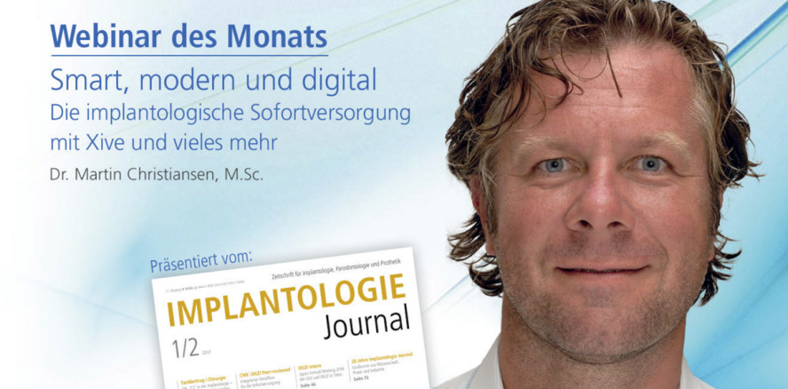 Webinar: Implantologische Sofortversorgung mit Xive