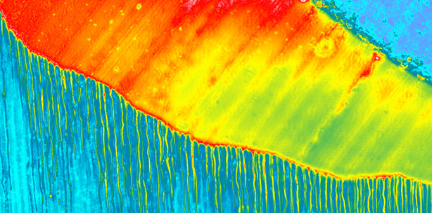 DT Study Club: Webinar behandelt dentale Adhäsivtechnik
