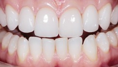 Ein Weg zur Ästhetik