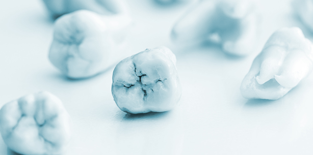 Au Backe! Komplikationen nach der Weisheitszahn-OP