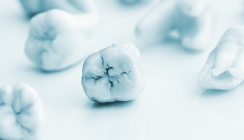 Au Backe! Komplikationen nach der Weisheitszahn-OP