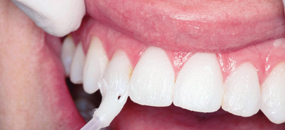 Der Einsatz für gesunde und strahlende Zähne lohnt sich