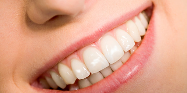 Harz-Füllungen gegen White Spots