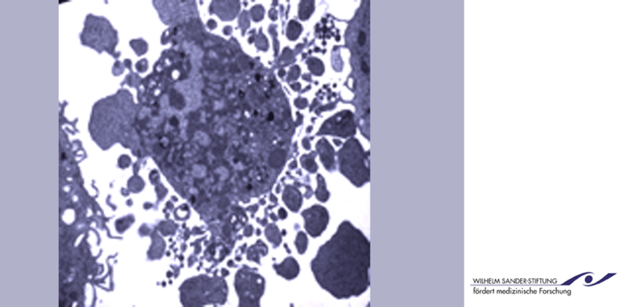 Gefahr weißer Hautkrebs: Was Hauttumorzellen unsterblich macht